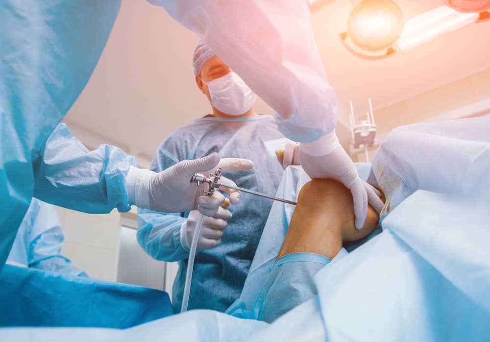 artroskopija kolena brez čakalne dobe