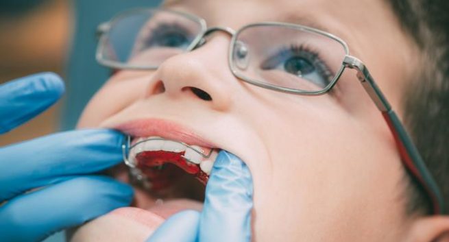 Prvi pregled pri ortodontu - otroci