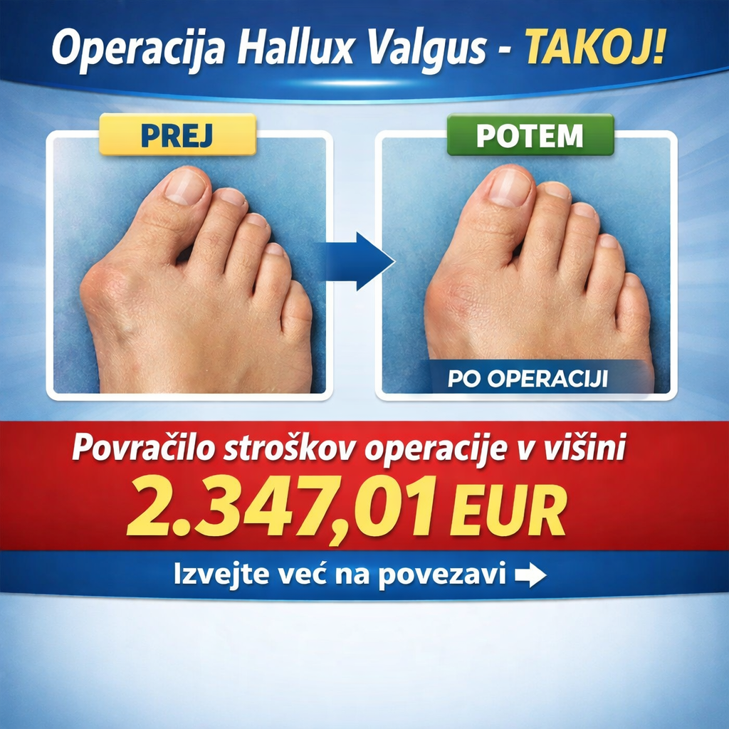 hallux valgus operacija