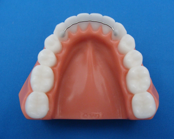 retencija zob žička